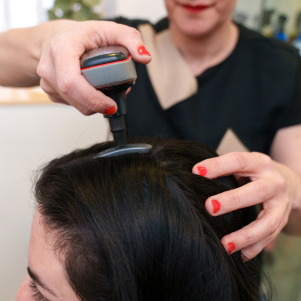 Scalp Treatment Services